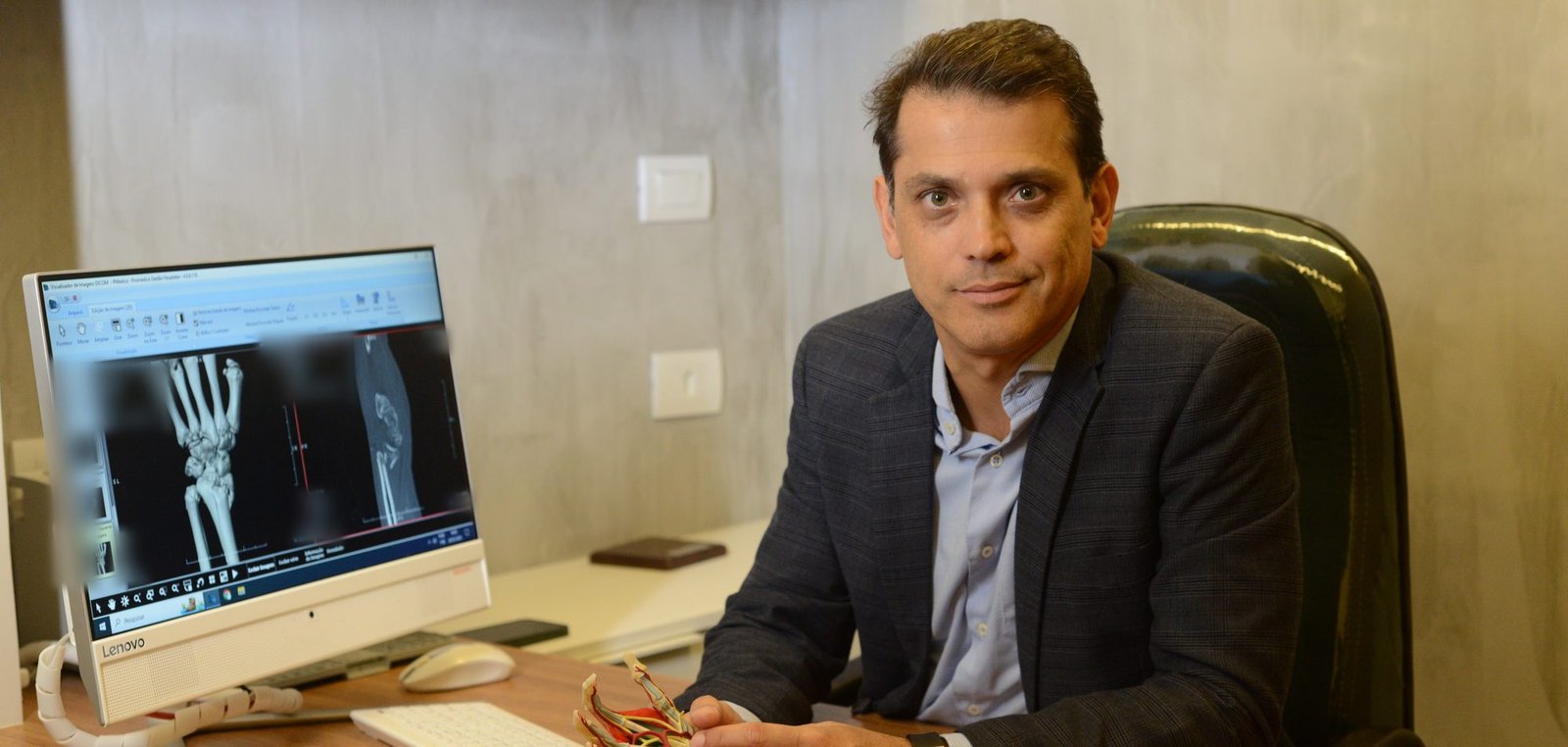 Dr. Max Lopes Jr em seu consultório, com modelo anatômico da mão e radiografia de punho na tela